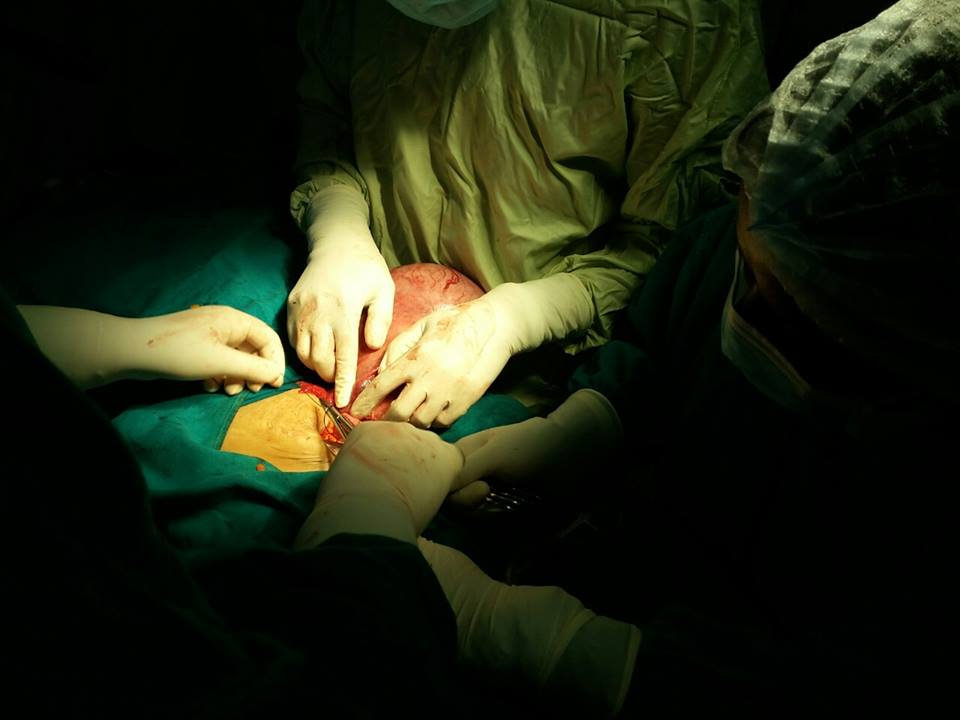 Pathager ko operation